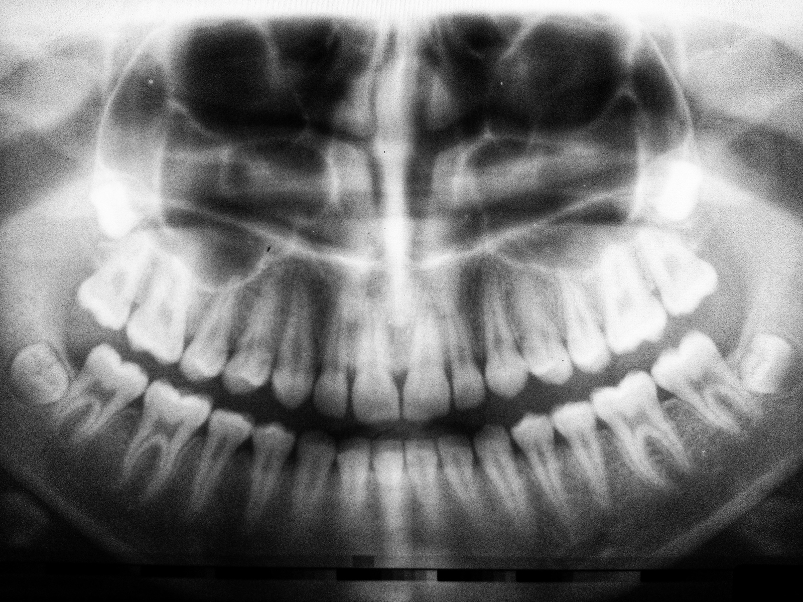 dental-xray dental x-ray