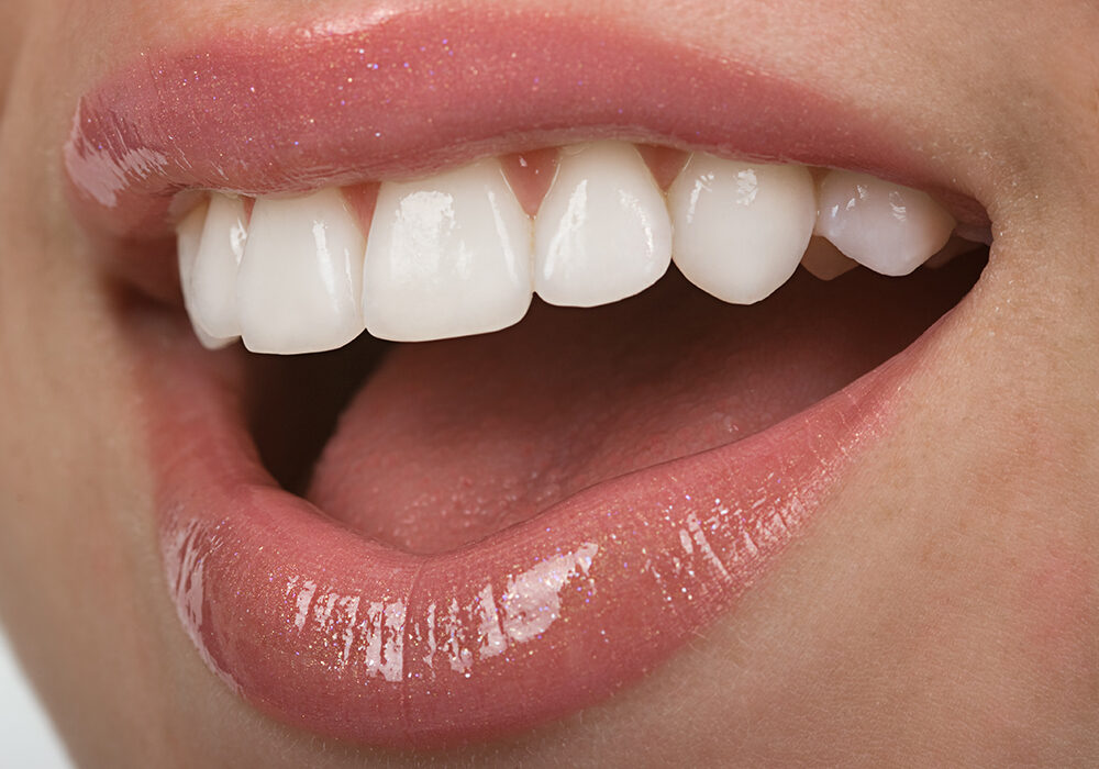 Woman with healthy, white teeth smiling